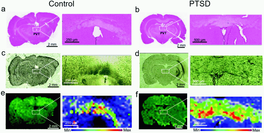 Histology and Raman imaging of brain tissues. 